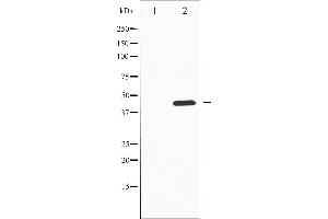 Western blot analysis of Tyrosine Hydroxylase phosphorylation expression in PC12 whole cell lysates,The lane on the left is treated with the antigen-specific peptide. (Tyrosine Hydroxylase 抗体  (pSer19))