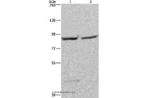 Western blot analysis of 293T and Hela cell, using GYS1 Polyclonal Antibody at dilution of 1:400 (Glycogen Synthase 1 抗体)