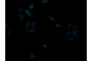 Immunofluorescence staining of HepG2 cells with ABIN7153367 at 1:133, counter-stained with DAPI. (GPRC6A 抗体  (AA 403-581))