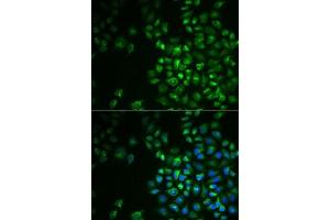 Immunofluorescence analysis of MCF7 cells using POLG2 antibody (ABIN6132502, ABIN6145894, ABIN6145895 and ABIN6222405).