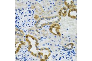 Immunohistochemistry of paraffin-embedded mouse kidney using POLG2 antibody (ABIN6132502, ABIN6145894, ABIN6145895 and ABIN6222405) at dilution of 1:100 (40x lens). (POLG2 抗体  (AA 216-485))