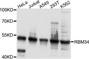 Western blot analysis of extracts of various cell lines, using RBM34 antibody. (RBM34 抗体)