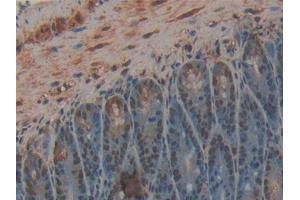 IHC-P analysis of Mouse Intestine Tissue, with DAB staining. (CPB2 抗体  (AA 113-422))