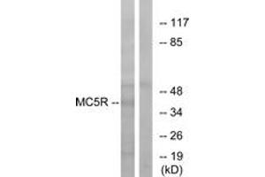 Western blot analysis of extracts from K562 cells, using MC5R Antibody. (MC5 Receptor 抗体  (AA 271-320))
