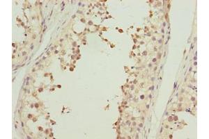 Immunohistochemistry of paraffin-embedded human testis tissue using ABIN7143059 at dilution of 1:100 (Actl7b 抗体  (AA 1-415))