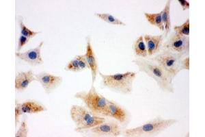 ICC testing of A549 cells