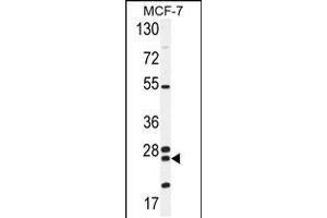 Western blot analysis in MCF-7 cell line lysates (35ug/lane). (NUDT8 抗体  (N-Term))