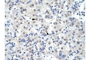 SF3B1 antibody was used for immunohistochemistry at a concentration of 4-8 ug/ml to stain Hepatocytes (arrows) in Human Liver. (SF3B1 抗体  (Middle Region))