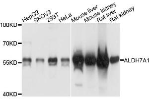 Western blot analysis of extracts of various cell lines, using ALDH7A1 antibody.