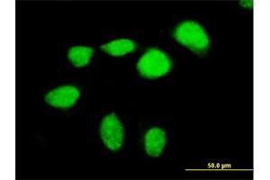 Immunofluorescence of purified MaxPab antibody to MEF2D on HeLa cell.