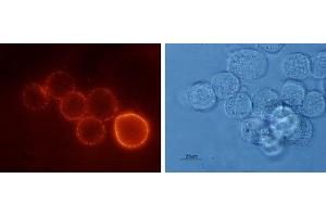 Expression of Bombesin receptor 2 in human HT-29 cells - Cell surface detection of BB2 receptor in live intact human HT-29 (colorectal adenocarcinoma) cells. (GRPR 抗体  (3rd Extracellular Loop))