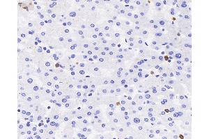 Immunohistochemistry analysis of paraffin-embedded human liver using MPO Polyclonal Antibody at dilution of 1:300. (Myeloperoxidase 抗体)
