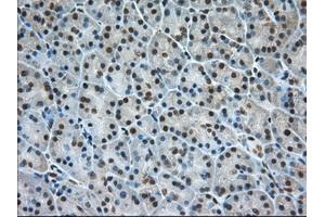 Immunohistochemical staining of paraffin-embedded Human Kidney tissue using anti-ERCC1 mouse monoclonal antibody. (ERCC1 抗体)