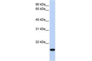 Image no. 1 for anti-Homeobox even-skipped homolog protein 2 (EVX2) (AA 154-203) antibody (ABIN6744266) (EVX2 抗体  (AA 154-203))