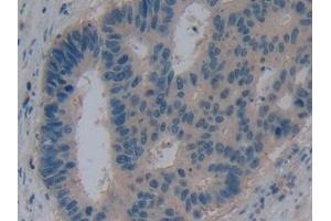Immunohistochemistry (IHC) image for anti-Aquaporin 1 (Colton Blood Group) (AQP1) (AA 201-269) antibody (ABIN7432100)