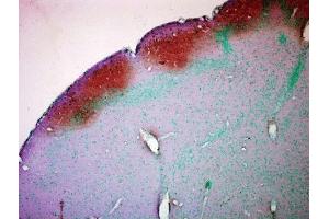 Immunohistochemistry analysis using Mouse Anti-CaMKII Monoclonal Antibody, Clone 22B1 . (CAMKII gamma 抗体  (FITC))