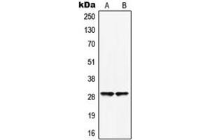 Western blot analysis of HOXB5 expression in HepG2 (A), HuvEc (B) whole cell lysates.