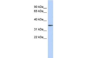 WB Suggested Anti-FBXO31 Antibody Titration: 0.
