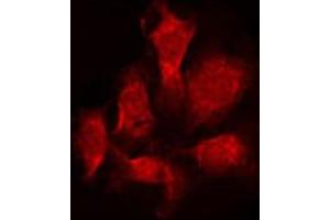 ABIN6274398 staining Hela by IF/ICC. (STEAP4 抗体  (C-Term))