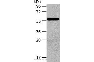 Western blot analysis of Hela cell, using HDAC7 Polyclonal Antibody at dilution of 1:100 (HDAC7 抗体)