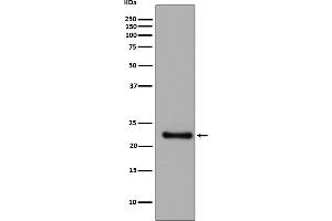 Western blot analysis of GPX1 expression in SH SY5Y cell lysate.