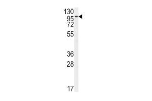 Western blot analysis of anti-FGFR2 Antibody (N-term R22) (ABIN391967 and ABIN2841763) in Hela cell line lysates (35 μg/lane).