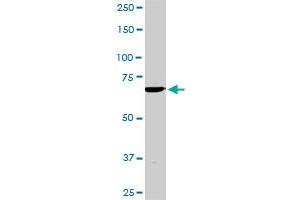 TBX3 monoclonal antibody (M02), clone 8H3. (TBX3 抗体  (AA 311-410))