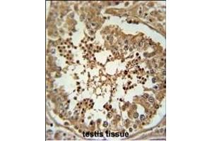 C Antibody (Center) (ABIN653885 and ABIN2843132) immunohistochemistry analysis in formalin fixed and paraffin embedded human testis tissue followed by peroxidase conjugation of the secondary antibody and DAB staining. (C3orf58 抗体  (AA 159-188))