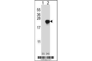Western blot analysis of ARL2 using rabbit polyclonal ARL2 Antibody (D170) using 293 cell lysates (2 ug/lane) either nontransfected (Lane 1) or transiently transfected (Lane 2) with the ARL2 gene. (ARL2 抗体  (C-Term))