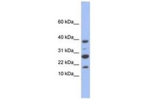 Image no. 1 for anti-NADH Dehydrogenase (Ubiquinone) 1, Subcomplex Unknown, 1, 6kDa (NDUFC1) (C-Term) antibody (ABIN6744061) (NDUFC1 抗体  (C-Term))
