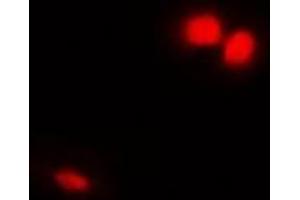 Immunofluorescent analysis of Emerin staining in Hela cells. (Emerin 抗体)
