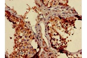 Immunohistochemistry (IHC) image for anti-NADH Dehydrogenase (Ubiquinone) 1 beta Subcomplex, 3, 12kDa (NDUFB3) (AA 2-65) antibody (ABIN7160920)