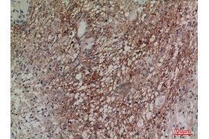 Immunohistochemistry (IHC) analysis of paraffin-embedded Human Brain, antibody was diluted at 1:100. (Neuregulin 2 抗体  (Internal Region))