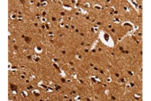 The image is immunohistochemistry of paraffin-embedded Human brain tissue using ABIN7131549(UPK3B Antibody) at dilution 1/25. (Uroplakin 3B 抗体)