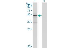Western Blot analysis of TNXB expression in transfected 293T cell line by TNXB monoclonal antibody (M01), clone 2D3-1B10. (TNXB 抗体  (AA 1-673))