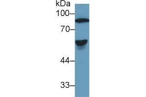 Detection of AT in Human Serum using Polyclonal Antibody to Antithrombin (AT) (SERPINC1 抗体  (AA 150-426))