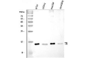 Western blot analysis of Prealbumin using anti-Prealbumin antibody (ABIN3042346).