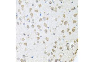 Immunohistochemistry of paraffin-embedded mouse brain using TARS antibody (ABIN5974207) at dilution of 1/100 (40x lens). (TARS 抗体)