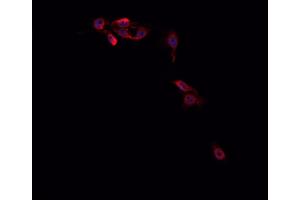 ABIN6266714 staining Hep G2 cells by IF/ICC. (MED14 抗体  (Internal Region))