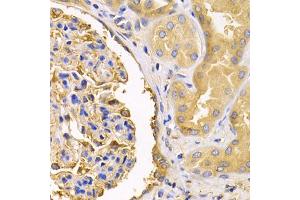 Immunohistochemistry of paraffin-embedded human kidney using USO1 antibody (ABIN1875291) at dilution of 1:200 (40x lens). (USO1 抗体)