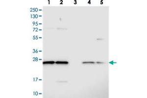 Western blot analysis of Lane 1: RT-4, Lane 2: U-251 MG, Lane 3: Human Plasma, Lane 4: Liver, Lane 5: Tonsil with C14orf166 polyclonal antibody  at 1:250-1:500 dilution. (C14orf166 抗体)