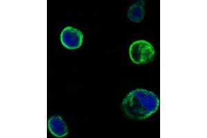 Confocal immunofluorescence analysis of HEK293 cells trasfected with extracellular MUSK (aa24-209)-hIgGFc using MUSK mouse mAb (green). (MUSK 抗体  (AA 24-209))