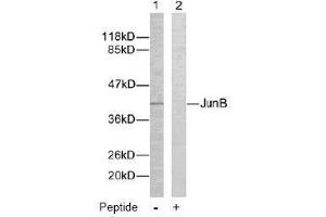Image no. 2 for anti-Jun B Proto-Oncogene (JUNB) (Ser259) antibody (ABIN197141) (JunB 抗体  (Ser259))