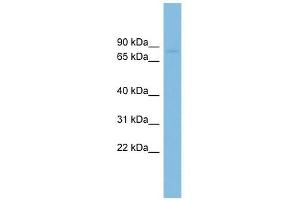 RAI16 antibody used at 1 ug/ml to detect target protein. (FAM160B2 抗体  (N-Term))