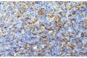 Immunohistochemistry of paraffin-embedded Mouse spleen using COX15 Polyclonal Antibody at dilution of 1:100 (40x lens). (COX15 抗体)