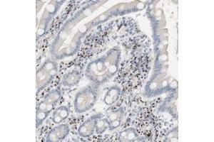 Immunohistochemical staining of human duodenum with MANEA polyclonal antibody  shows distinct cytoplasmic positivity in a sub-set of inflammatory cells at 1:10-1:20 dilution. (MANEA 抗体)