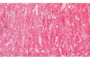 Detection of ICAM5 in Human Cortex Tissue using Polyclonal Antibody to Intercellular Adhesion Molecule 5 (ICAM5) (ICAM5 抗体  (AA 409-674))