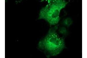 Anti-QPRT mouse monoclonal antibody (ABIN2453564) immunofluorescent staining of COS7 cells transiently transfected by pCMV6-ENTRY QPRT (RC202960). (QPRT 抗体)