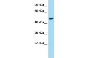 Host: Rabbit Target Name: L2HGDH Sample Type: HepG2 Whole Cell lysates Antibody Dilution: 1. (L2HGDH 抗体  (Middle Region))