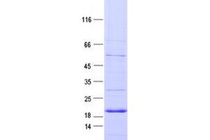 Validation with Western Blot